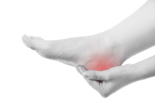 Bệnh lý bàn chân: Viêm Cân Gan Chân và giải pháp lâu dài (Phần 1)